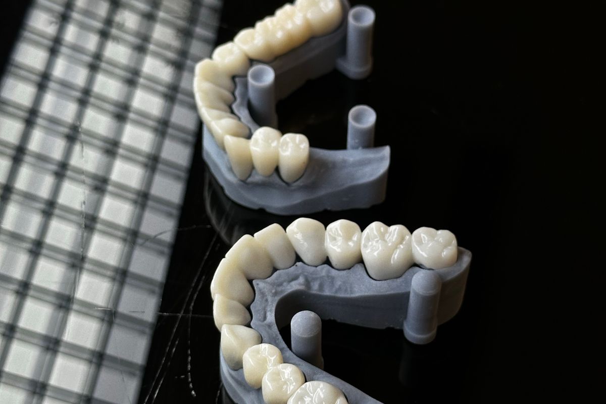 Finished crown restorations seated on working models