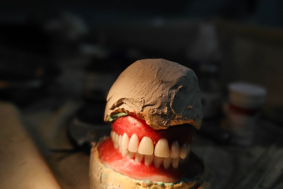 Complete denture on an articulator at MARS USA Dental Lab