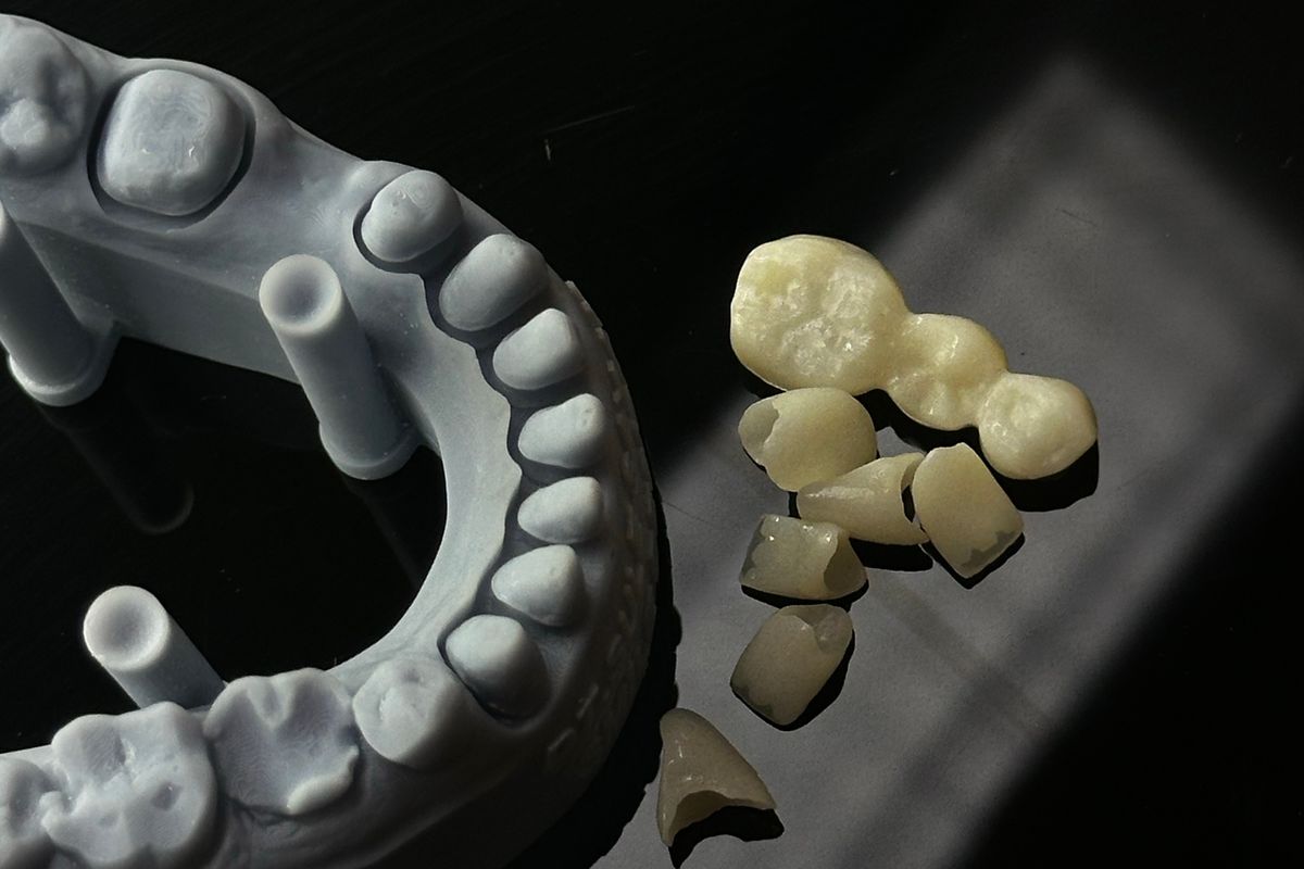 Pressed ceramic crowns and a printed model at MARS USA Dental Lab