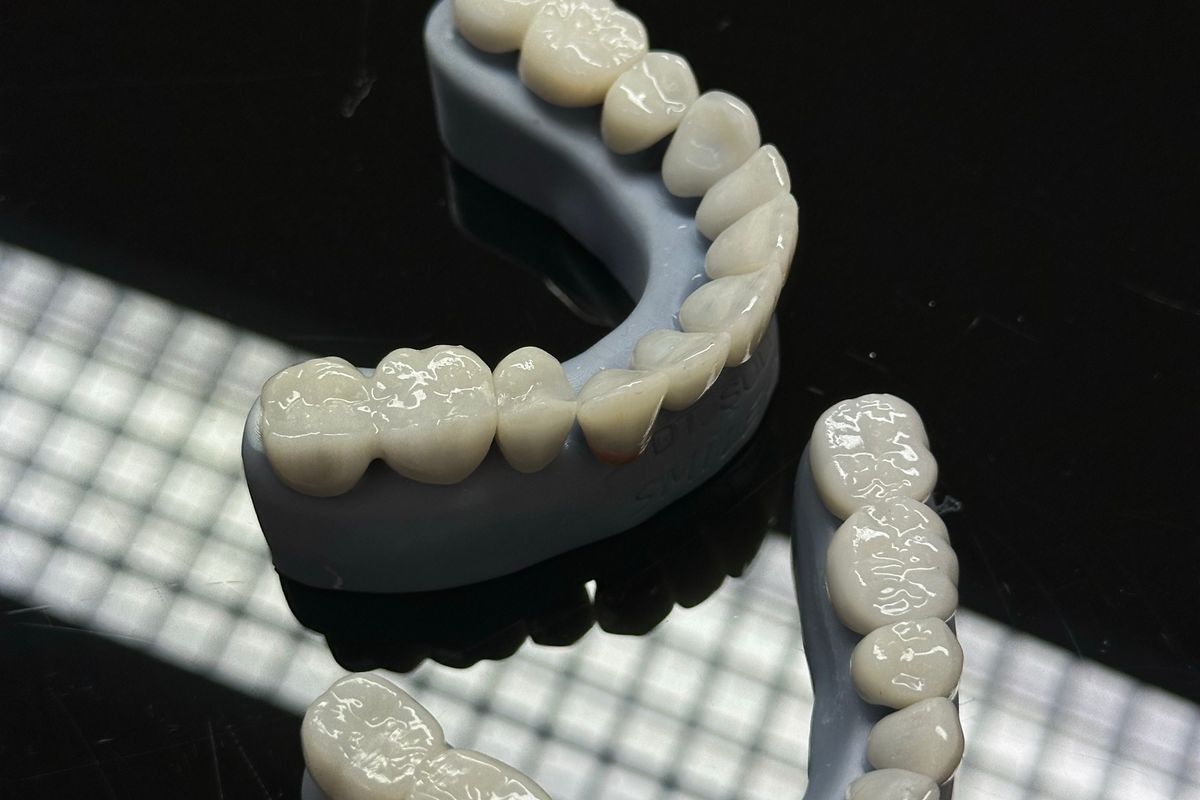 Premium dental crowns crafted by MARS USA Dental Lab